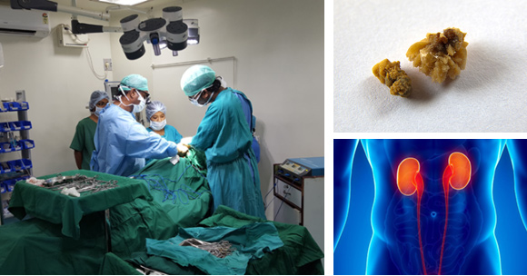 Epic Urology Clinic - Chennai