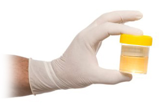 Urine Infection